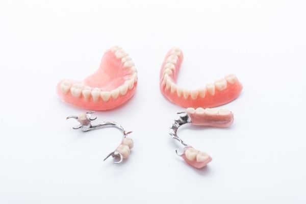 Denturologie – Prothese partielle – Centre dentaire Ruel a Chambly Denturologie - Prothese partielle - Centre dentaire Ruel a Chambly